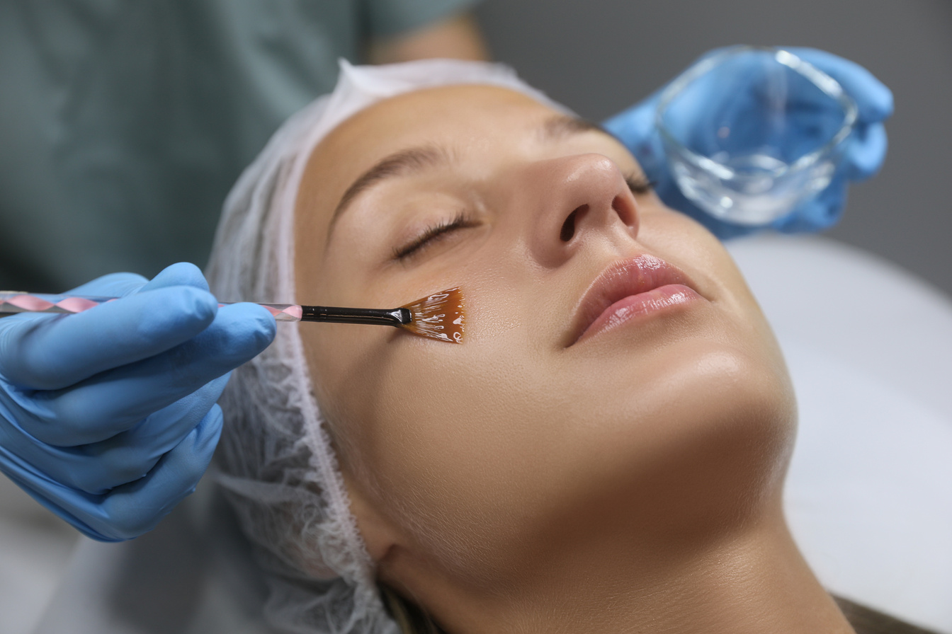 Cosmetologist Applying Cosmetic Product for Chemical Peeling on